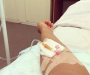 Жительницу Сумщины госпитализировали с подозрением на «сибирскую язву»