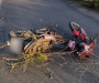 На Сумщині у ДТП травмувався мотоцикліст